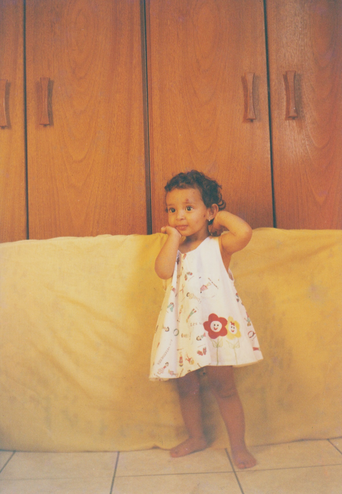 Isabella já recuperada, fazendo as artes de criança. A que mais demorou para sumir foi a da testa, que ainda hoje ficou uma marquinha.